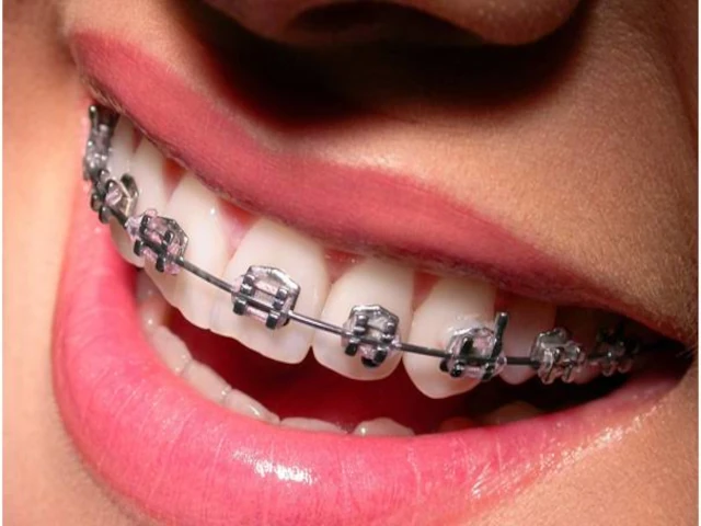 AHLEM HELIMET  HAPPY DENTAL