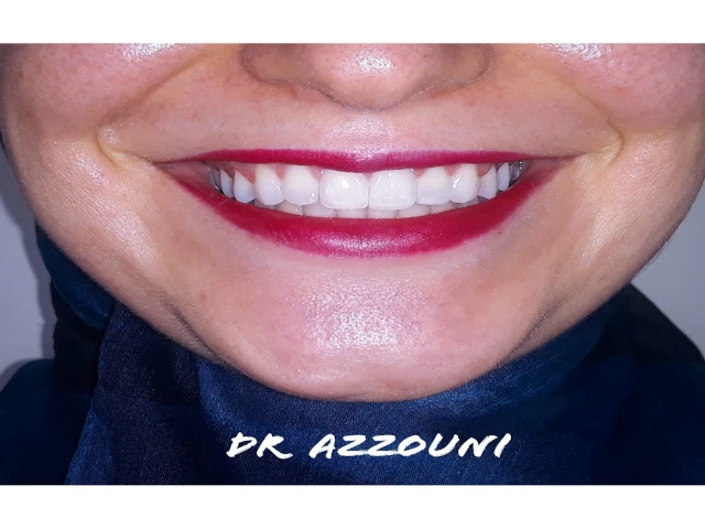 HIDAYET AZZOUNI