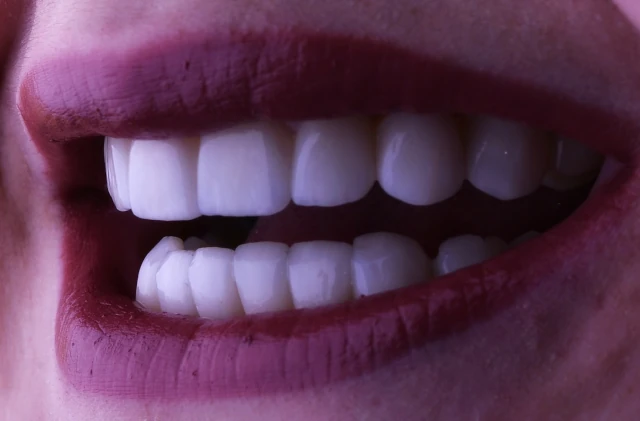 Docteur YOUNES  ALPHA DENTAL