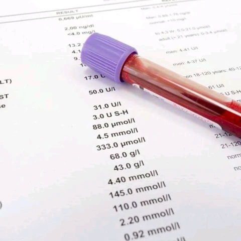 Laboratoire d'analyses médicales TOUAM