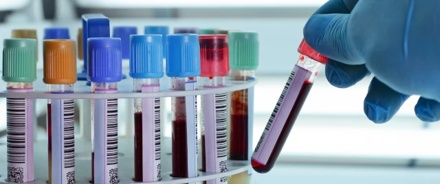 Laboratoire d'analyses médicales IBN SINA