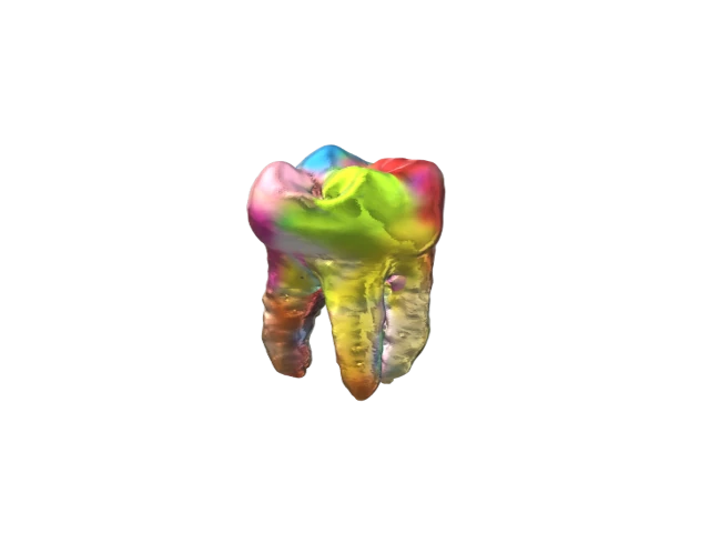 KEIRLESS