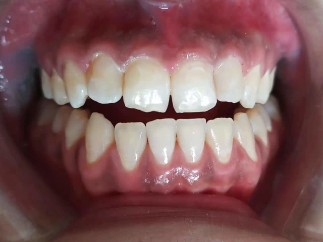 HAPPY SMILE