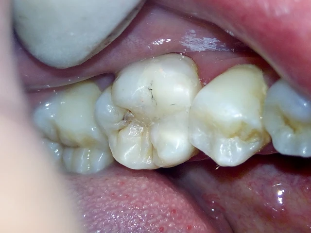 AF1QipM08IAUuicX1ZvabFd0XKOgiJHJj_LHvS_TsHJ3w1920-h1080-k-no.webp