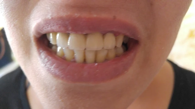 AF1QipM0nBJjKSKrXf6ezweyMg8BL5x0QrdiWwpL1E-hw1920-h1080-k-no.webp