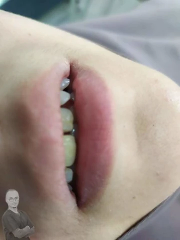 AF1QipM6oQUYhR5AIw6ElA68_jKk_AsNL2anPfyK9WZLw1920-h1080-k-no.webp