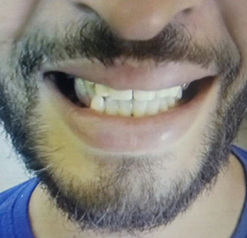 AF1QipMAbDiqfhF9YRE4564ESrvBSA2F83t8GjTv6kbPw1920-h1080-k-no.webp