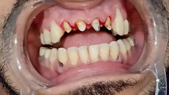 AF1QipMWv-So0HJERI8Rmo0PjlaWZPGEkHOTyCAbtdpbw1920-h1080-k-no.webp