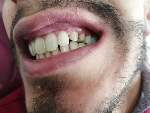AF1QipMfXZvNh91ZG9GkPz1fsZqPcm1hD8KSSBEAAqHHw1920-h1080-k-no.webp