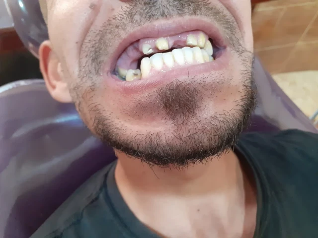 AF1QipMgXriDburLVJbi9F8Nn530IOu6xgby3d-i9P3Qw1920-h1080-k-no.webp