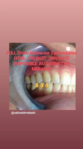AF1QipMrTdpWPbaC2C6Qreuw-osX-WSSSMUl_H7rkcfUw1920-h1080-k-no.webp