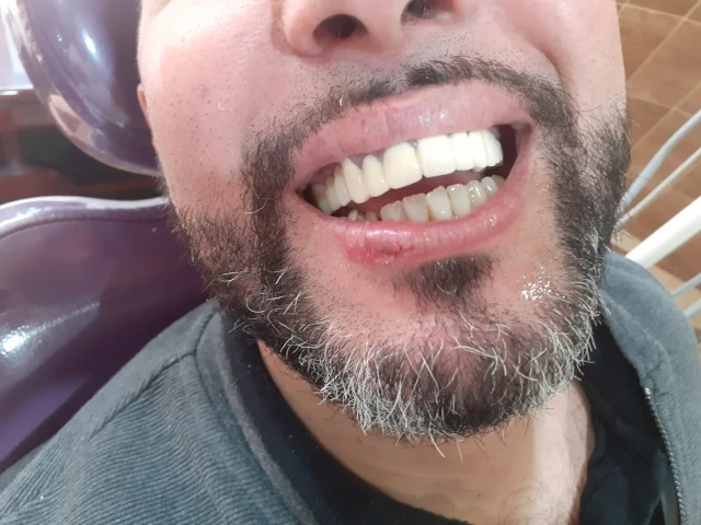 AF1QipMzVsHC9i1kQsRhmO9uA_UVVg-KC-rjLnFfrauGw1920-h1080-k-no.webp