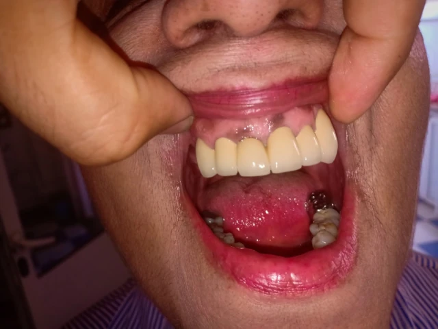 AF1QipNGMyMNc3rCpOOQsJUbHre6-3okHq141Yyvlb83w1920-h1080-k-no.webp