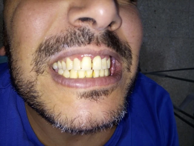 AF1QipN_RqY18u3Gzy-99crwqlJJnvJsAEvhnElFCBHNw1920-h1080-k-no.webp