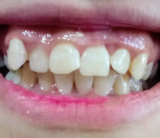 AF1QipNrOShuWyg5r2IN4LlWHsepBxxAeMpLy9AZXN59w1920-h1080-k-no.webp
