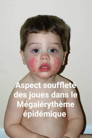 AF1QipNtlkYGfVnILiPcCsJGTSh9WRdpYmWDVeuwPJeVw1920-h1080-k-no.webp