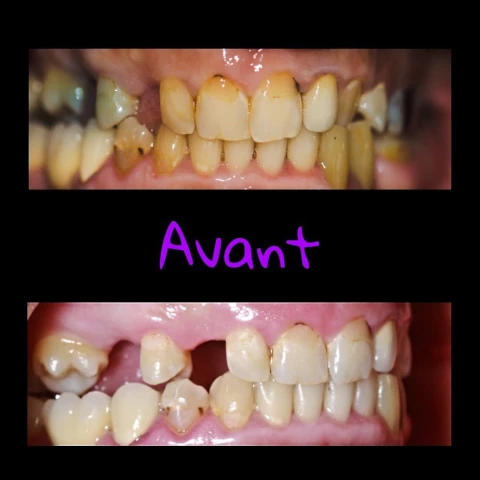 AF1QipNu35JN9-cUan7v2PTrfZsGsYQtk8HGeXXiktzGw1920-h1080-k-no.webp