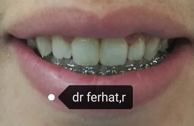 AF1QipNwl1OWdKBs_WfPVExXkSuxNkzoFr-aRZRw1K4Qw1920-h1080-k-no.webp