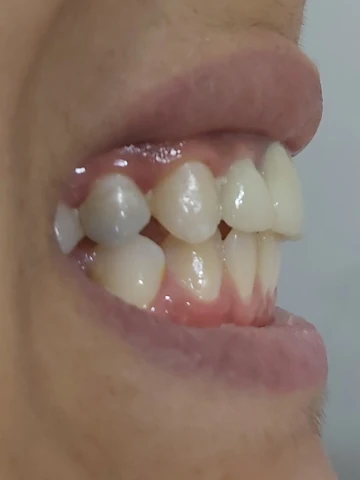 AF1QipOHTi5lyghHwQge9eft3t4YOO-9_UFGVwg_yDQKw1920-h1080-k-no.webp