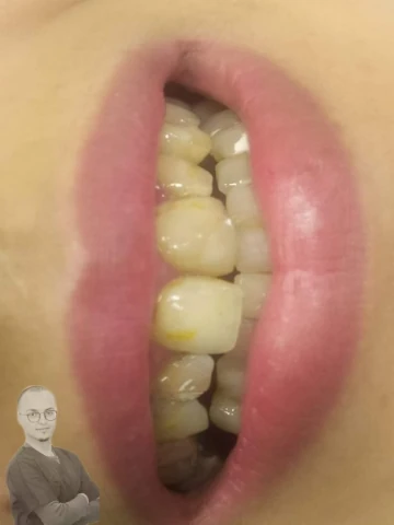 AF1QipORCgEJCoP6fatgCnAq1n8vX6EdJf2ukex0KOoww1920-h1080-k-no.webp