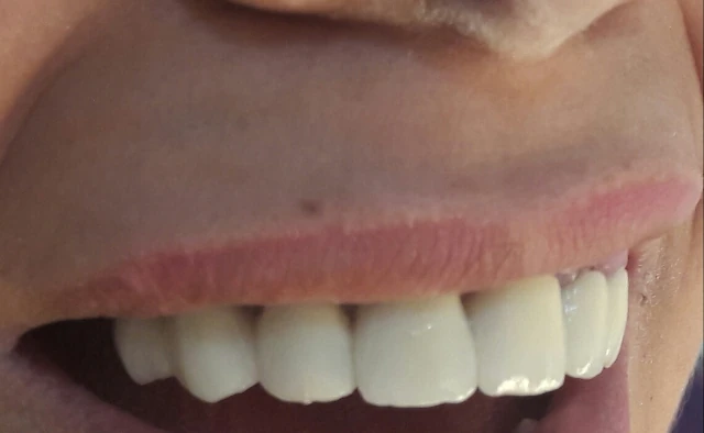 AF1QipOX_pkIyUS1BZrMEHP5VAoIslEMz4TP_fjaD894w1920-h1080-k-no.webp