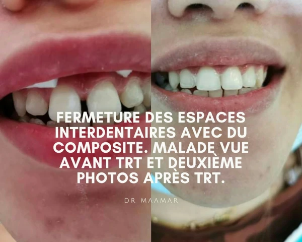 AF1QipP41G83l1zfx0j5UdY2SL_XBrU4ObMz5NH37jllw1920-h1080-k-no.webp