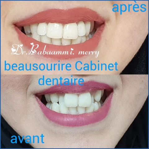 AF1QipP6vMUbp9DFjoU8vxSmANWzoBfZ0iOrSvcnleiFw1920-h1080-k-no.webp