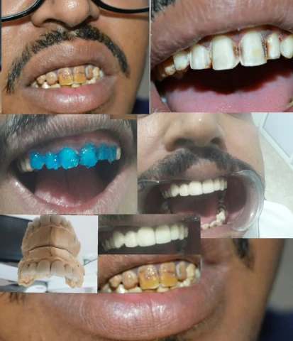 AF1QipPJwxNs9GU1rjzCR9Kb3hPidKD4MGCwarCEoDAkw1920-h1080-k-no.webp