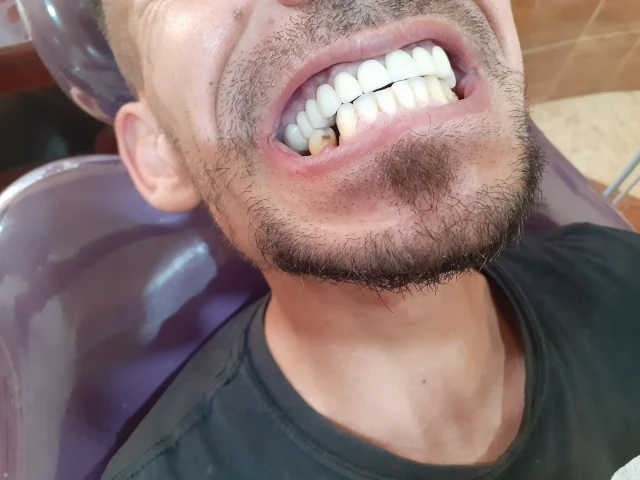 AF1QipPgX0P2L4Khmc0eAZkhXryWDA8S3tTBh9Ffvvynw1920-h1080-k-no.webp