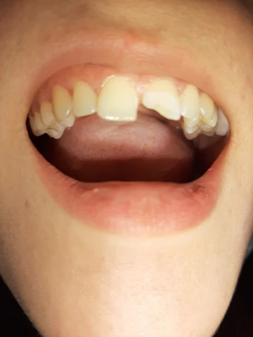 AF1QipPkPBl4NlpsSuLJqlA3thN0Ak2FKBl56CxiqKiQw1920-h1080-k-no.webp