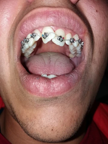 AF1QipPsFKD29lQJwrJJqW2tMzBskowf-2bFp70a-JxWw1920-h1080-k-no.webp