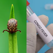 fievre-hemorragique-de-crimeecongo