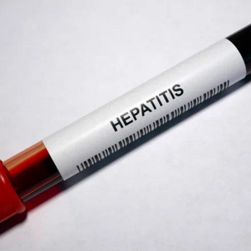 insuffisance-hepatique