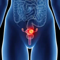 maladies-des-organes-reproducteurs-feminins