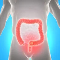 maladies-du-rectum-et-de-lanus