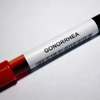 gonorrhee