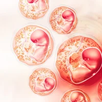 hematome-retroplacentaire