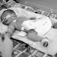 accouchement-premature