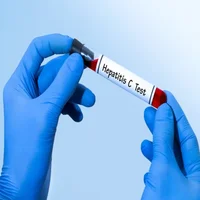 hepatite-c
