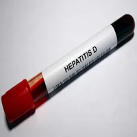 hepatite-d