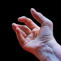 arthrite-reactionnelle