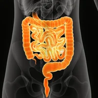 cancer-intestin-grele