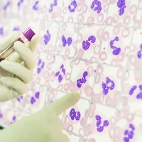 defauts-morphologiques