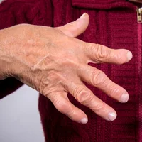 deformation-en-boutonniere