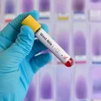 infection-par-le-virus-du-nil-occidental