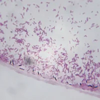 infections-a-clostridium