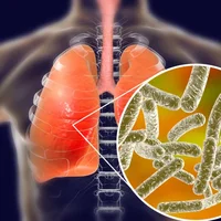 infections-a-legionella