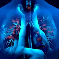 infections-mycobacteriennes-non-tuberculeuses