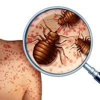 infestation-de-punaises-de-lit