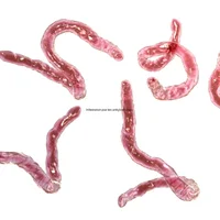 infestation-par-les-ankylostomes